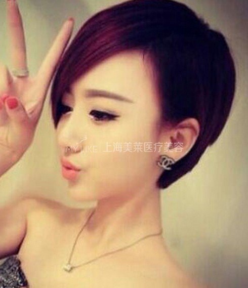 botox瘦脸的三大常识