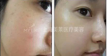 不做“女旱子”, <wbr>快做水光吧!