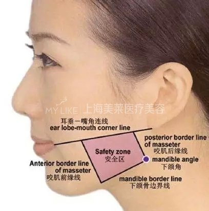 瘦脸问题大全,看完你都知道了!