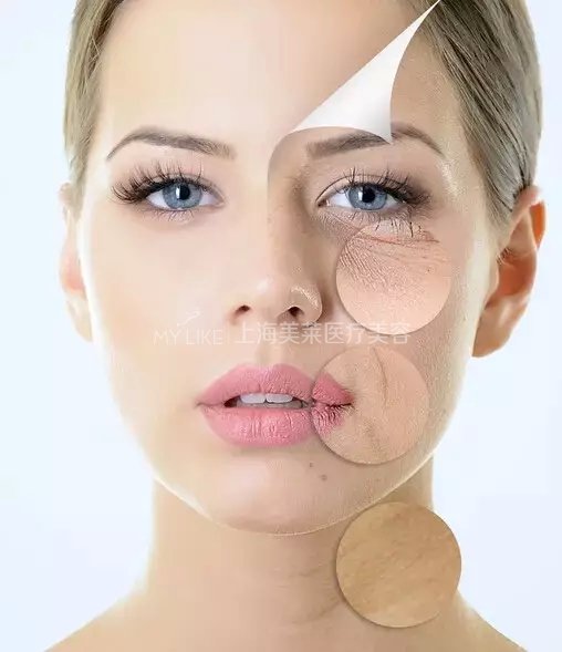 想要容貌焕然一新,20、30、40岁如何微调?